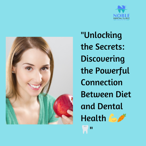 🔍 It's true! The foods and drinks we consume play a significant role in the health of our teeth… post image