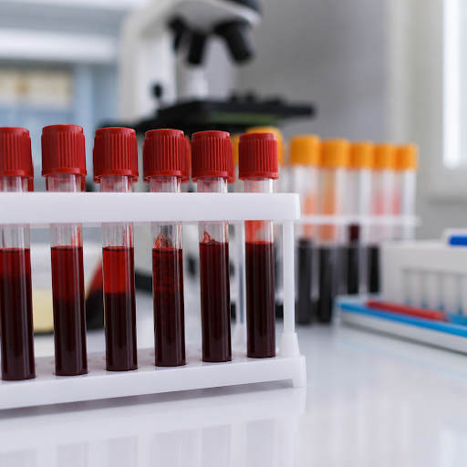 Staying healthy starts with understanding your regular blood tests. At नकुल पैथोलॉजी लैब एंड हेल्…