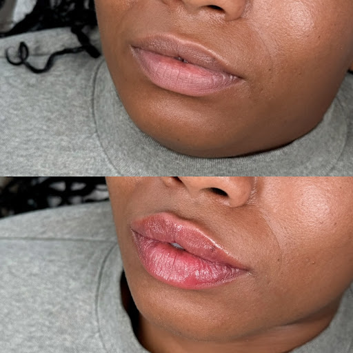 Luna Aesthetics MedSpa