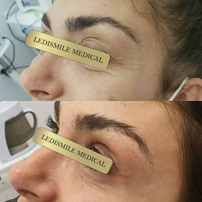 Klinikë estetike Ledismile Medical - Aesthetic & SPA