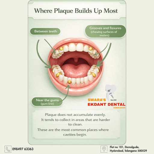 Best Dental Clinic In Domalguda. #domalgudadental #domalgudadentalhyderabad #domalgudadentaland #… post image