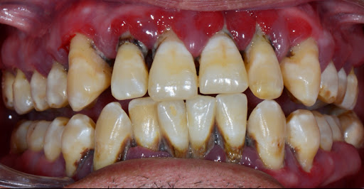 Dra. Dana Pinto. Periodoncia e implantologia