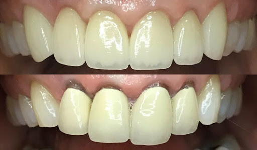 Meadowbrook Dental - Thumbnail