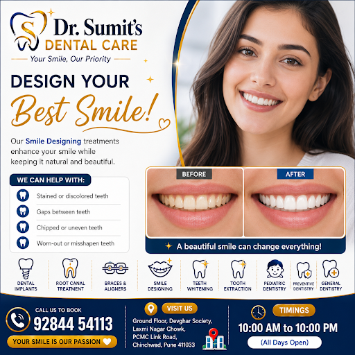 Smile designing in Chinchwad  post image