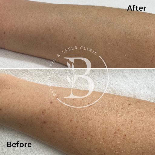 Belmont Skin and Laser Clinic Gallery - United Kingdom