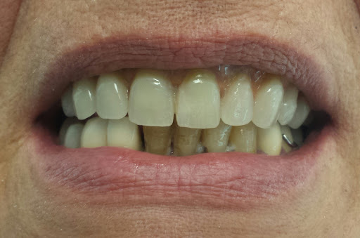 Studio Dentistico Dott. Di Rollo Pierluigi - Thumbnail