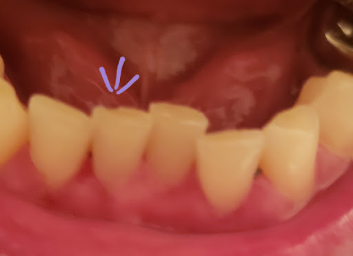 Stacey Family Dental