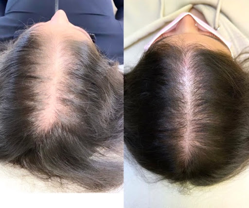 Best Cosmetologist In Mansarovar

#LUMINASKIN&AESTHETICCLINI