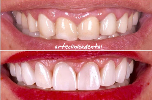 ARTE CLINICA DENTAL - Thumbnail