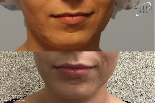 Allure Medical
