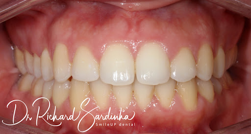 SmileUp Dental - Thumbnail