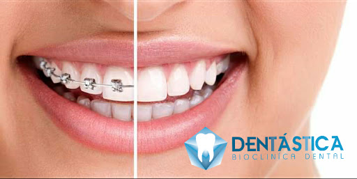 Dentástica.Cln - Thumbnail