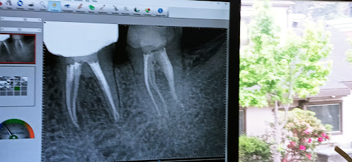Endospecialists- Root Canal Specialist - Thumbnail