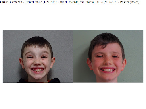 Patritto Orthodontics - Thumbnail