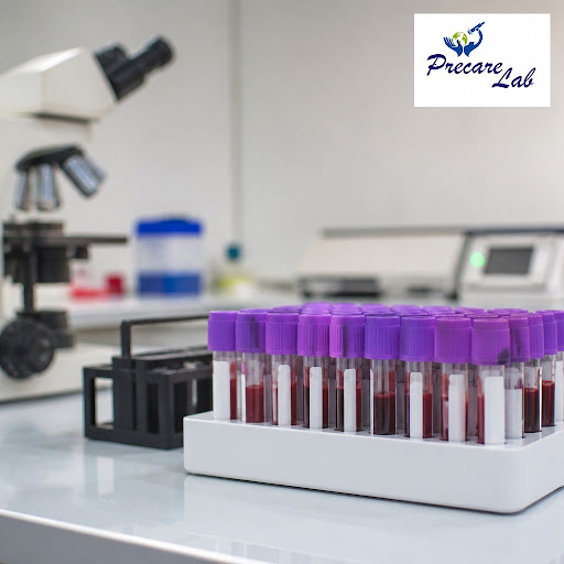 Living with diabetes, thyroid issues, heart disease or hypertension? Regular lab tests are the ba… post image