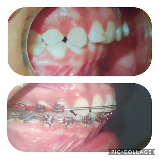 Consultorio Dental C.D. Fatima Gpe. Tinajero Perez - Thumbnail