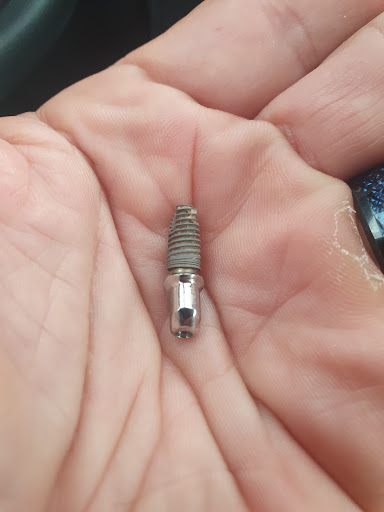 Clínica Dental Implantdent Empuriabrava - Thumbnail