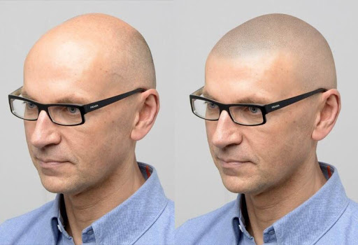 micro haar - Visual