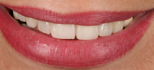 Consultorio Dental. Rehabilitación Oral.