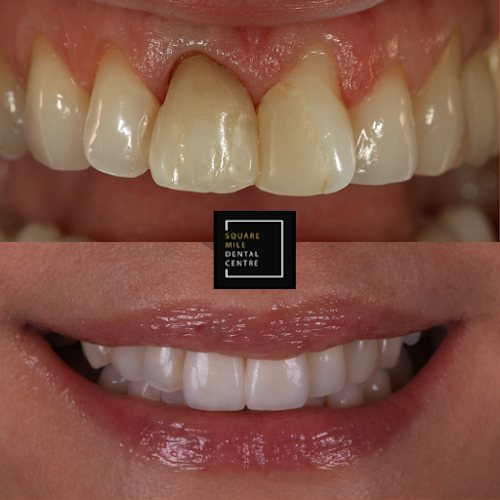 Square Mile Dental Centre Phone number