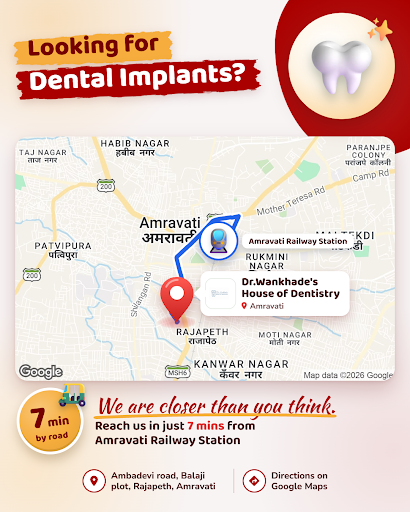Looking for dental implants in Amravati? Dr.Wankhade's House of Dentistry is just 7 minutes from… post image