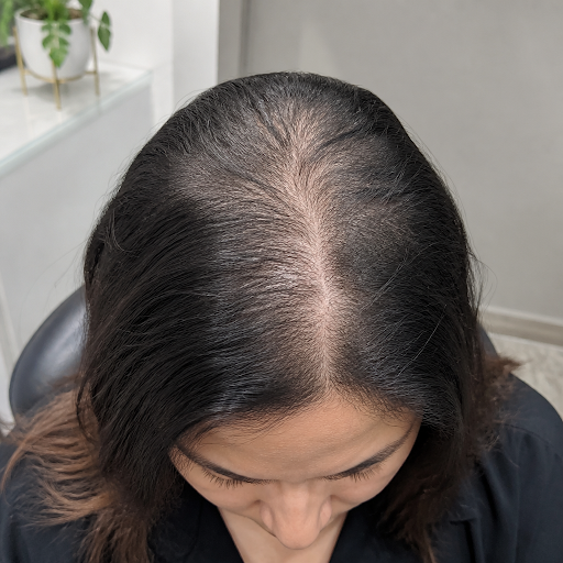 Struggling with widening parting or see-through patches on your scalp? At Aura Brow by Priyanka i… post image