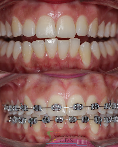 Clinica Dental & Ortodoncia O.D.S/ Dr. Eric Romero Ortodoncista de niños y adultos