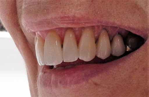 Tandartsenpraktijk Annen - Thumbnail