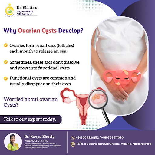 Why Ovarian Cysts Develop?