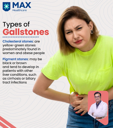 #DrAshishSachan #noida #cholestreolstones #pigmentstones #suddenpain #healthtips #stayhealthy #kn… post image