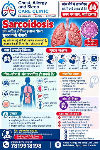 Sarcoidosis –