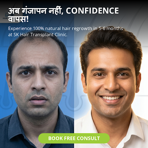 The SK Hair Transplant Clinic in Sector 44, Noida NCR, provides excellent hair loss control and i…