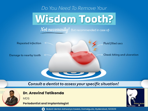 Do You Need To Remove Your Wisdom Tooth? post image