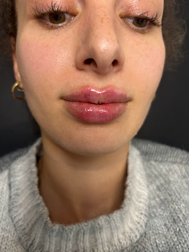 Lume Beauty Aesthetics - Thumbnail