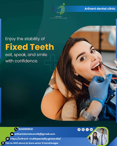 Fixed Teeth (Implants) Full‑Mouth Fixed Teeth. post image