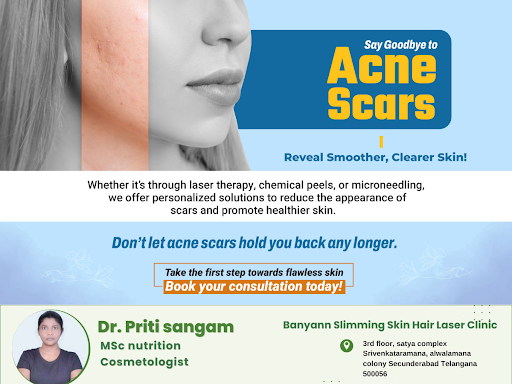 Say goodbye to acne scars and embrace a clearer complexion with our advanced treatments like lase… post image