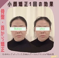 小顔矯正専門店 シンメトリー銀座店