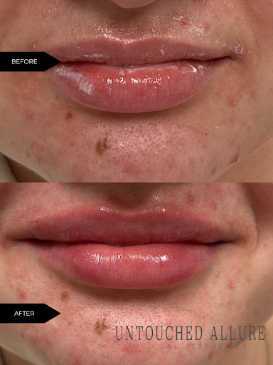 Untouched Allure Medical Aesthetics