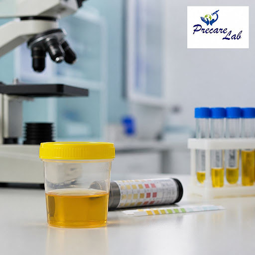 Urine analysis is a simple test that gives powerful insights into your kidney health. At Precare… post image