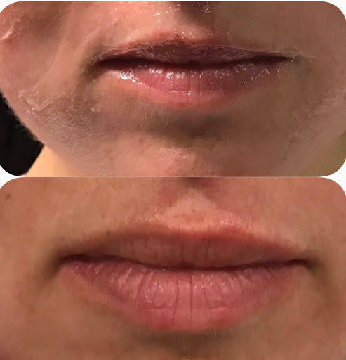 Inner Glow AestheticsMD