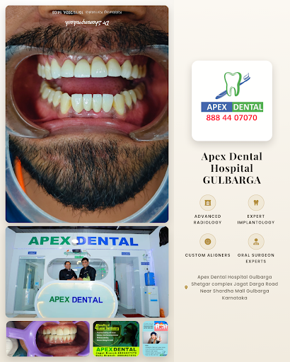 Apex Dental Hospital GULBARGA offers expert dental radiology services to support your smile with… post image