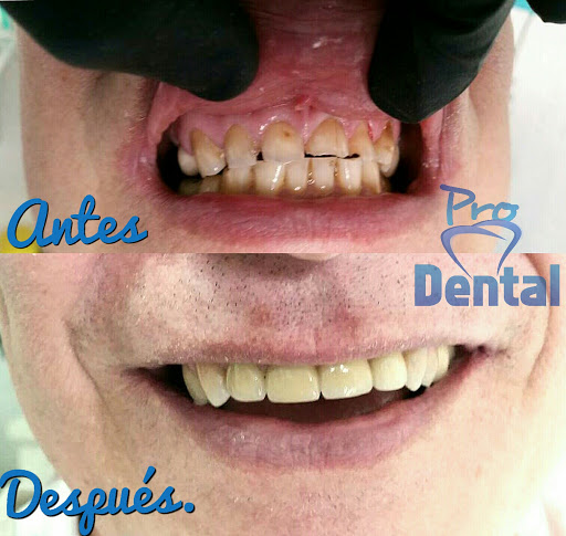 Consultorio dental ProDental San Cristóbal de Las Casas - Thumbnail