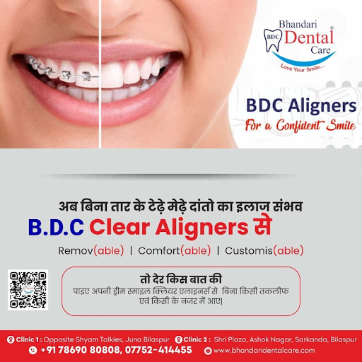 Clear Aligners post image
