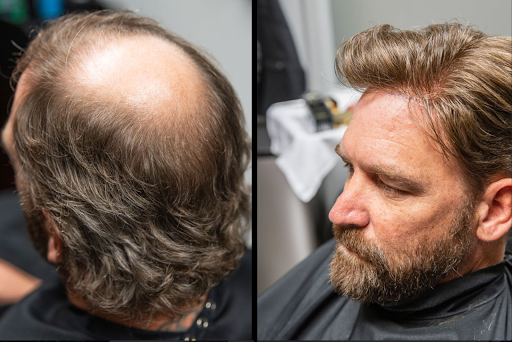 bombay hair clinique - Thumbnail