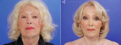 Photos of Garth Fisher, MD, FACS