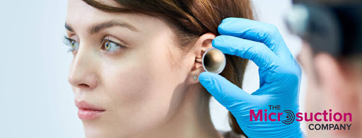 The Microsuction Company | Ear Wax Removal & Hearing Clinic