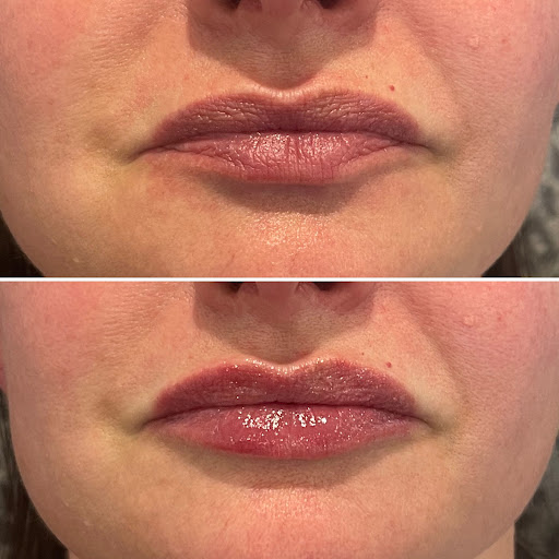 The Injection Studio