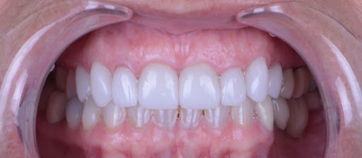 10 Dental Design Studio - Thumbnail