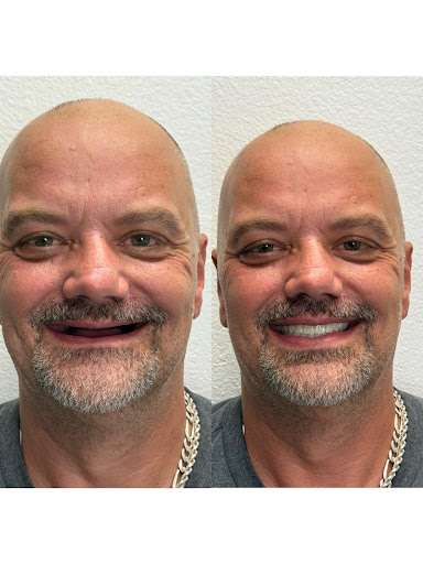 Park Row Dental - Dental Office Arlington TX