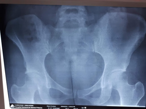 Dr. Federico Bernabe Garcia, Algólogo - Thumbnail